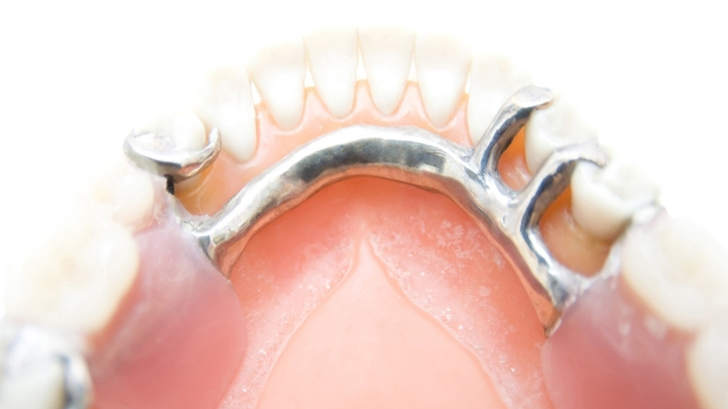 噛みやすい最新入れ歯の種類と値段（保険あり） - 三重県伊勢市入れ歯専門外来・山口歯科医院